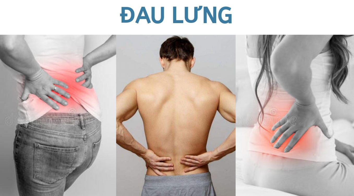 Cách bấm huyệt trị đau lưng